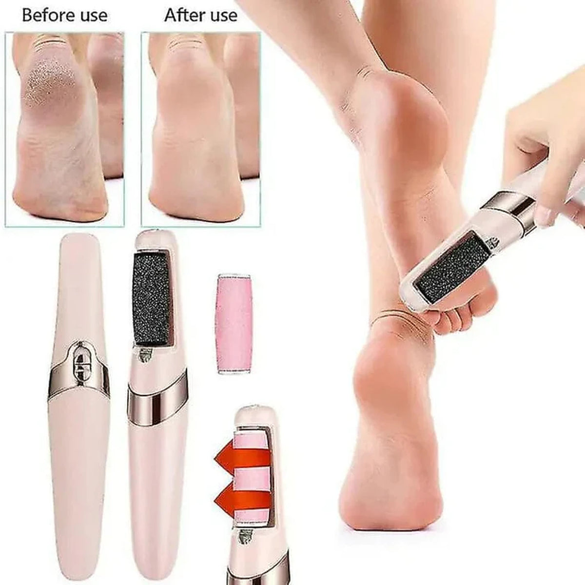Flawless Pedi Electronic Pedicure Tool – Rechargeable Callus Remover